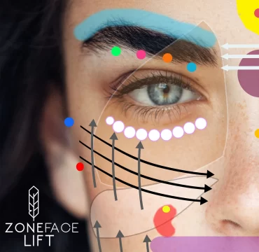 zone face lift image